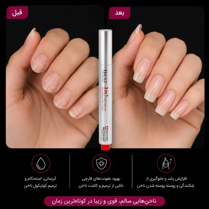 سرم تقویت ناخن